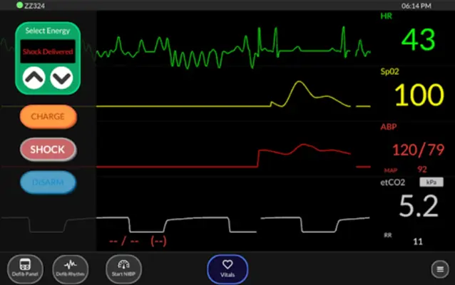 Simpl - Simulated Patient Monitor android App screenshot 2